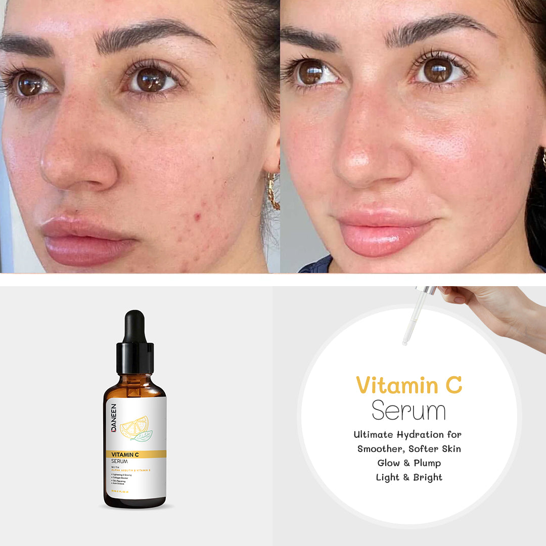 VITAMIN C SERUM