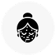 Acne scars and marks