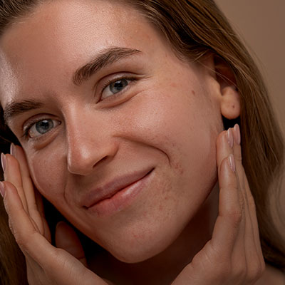 Combination Skin Type